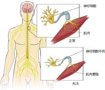 脖子疼、手麻就一定是颈椎病吗?那是因为你不