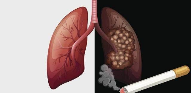 戒烟多久才算成功满足了这3点的话,恭喜你成功