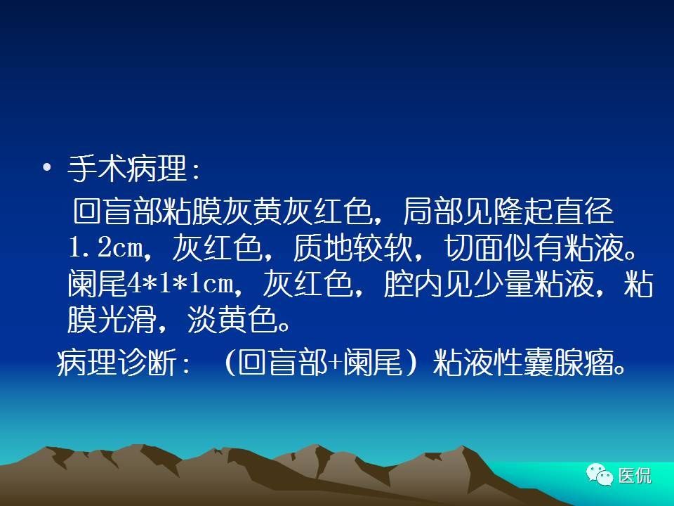 实战病例丨急性阑尾炎的鉴别诊断#医学影像#