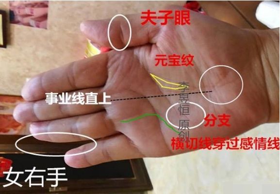 手上一旦出现 X 字 Y 纹 纹富人忧 穷人愁的婚姻符号 雪花新闻 手上一旦出现 X 字 Y 纹 纹富人忧 穷人愁的婚姻符号 雪花新闻