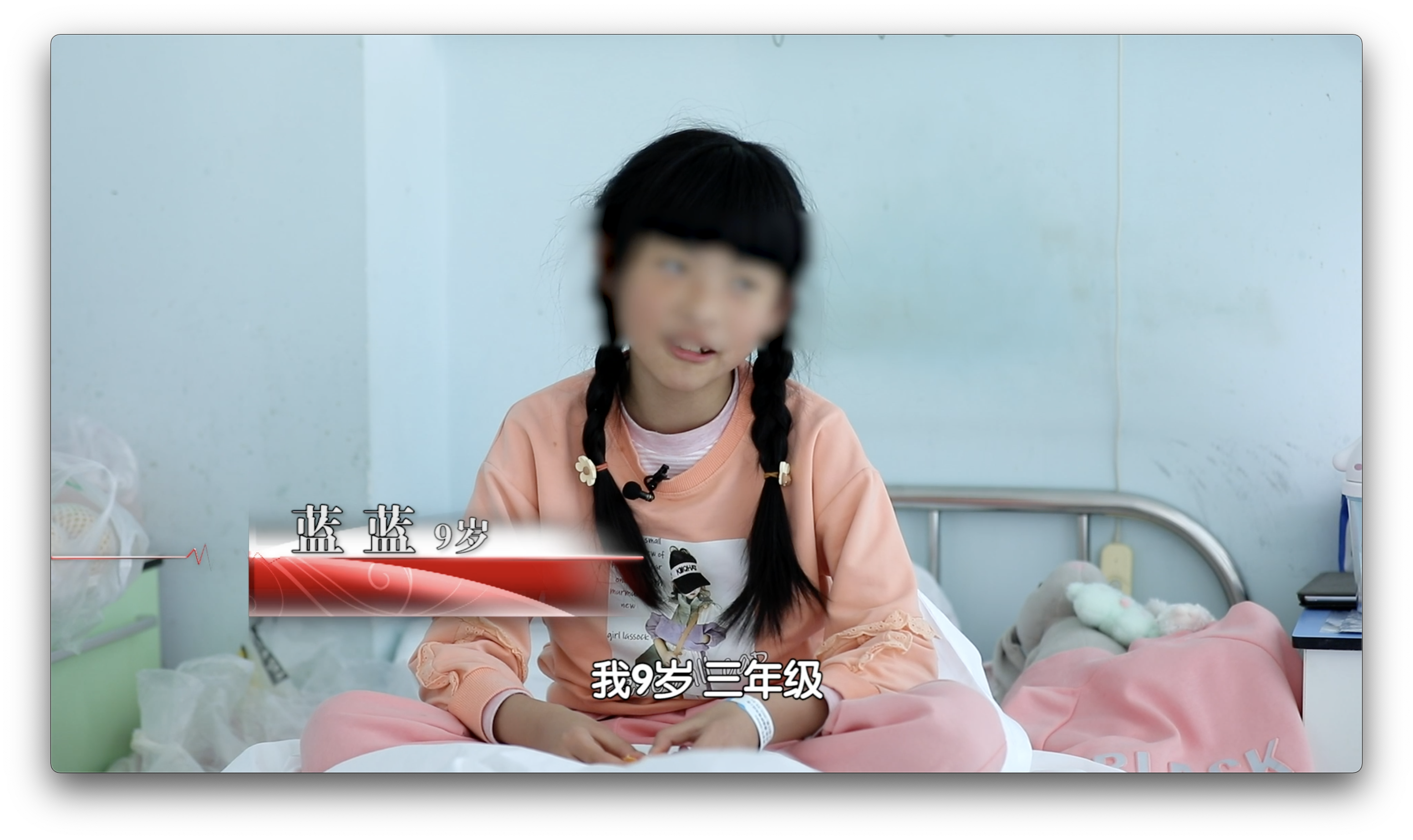 9岁女孩不明原因腹痛两年 肚中竟暗藏巨大的罕见肿瘤