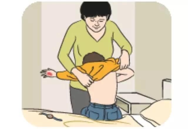 儿童烧烫伤,请牢记这些紧急处理办法,第一点最