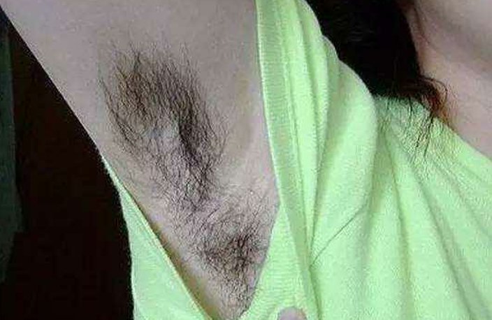 女人腋毛又黑又长?穿裙子真心难看,教你一招,