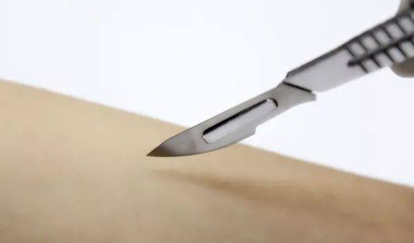 肺癌早期能治愈吗 肺癌手术后的5个治疗方法