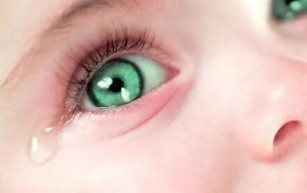 儿童过敏性结膜炎容易忽视,出现这些症状要当