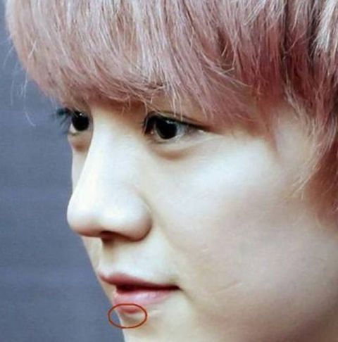 娱乐圈5大明星脸上的伤疤,杨幂的很是奇葩,最后一位的很严重!