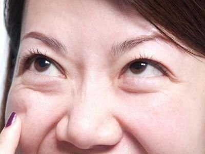 当维生素e遇上了它,每天擦一擦,三次眼袋不见