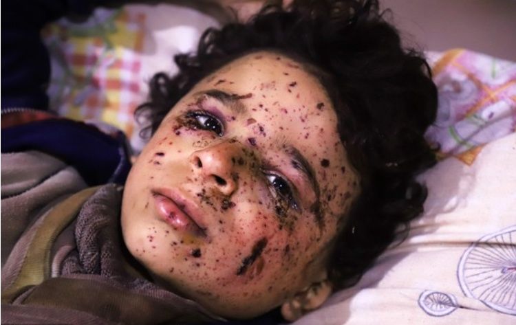 疑俄发动空袭!叙利亚东古塔学校 遭3枚导弹击中15儿童死亡