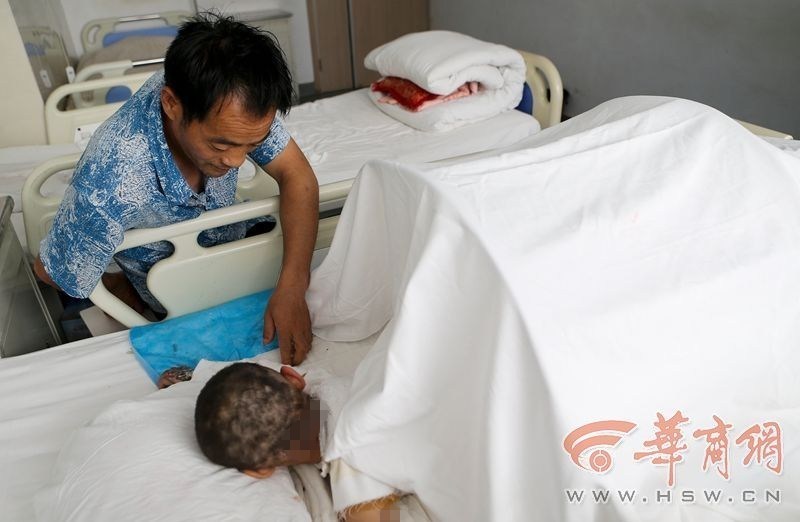 奶奶转身取碗瞬间 3岁女童跌进开水锅 奶奶转身取碗瞬间 3岁女童跌进开水锅