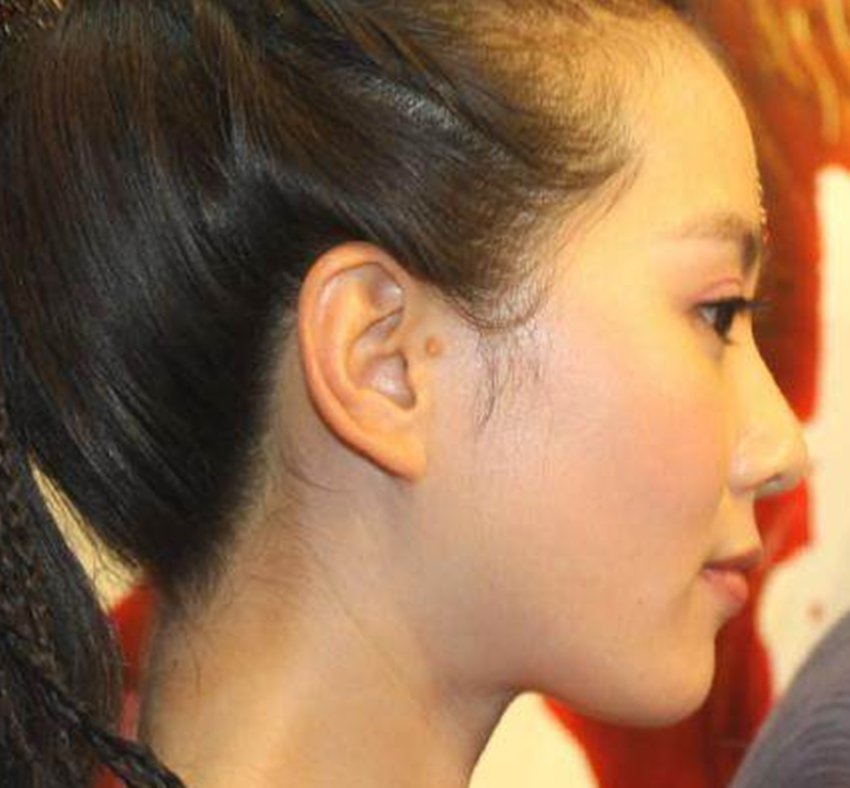 有"身体缺陷"的6大明星,刘诗诗多一只"耳朵",她没有肚脐眼