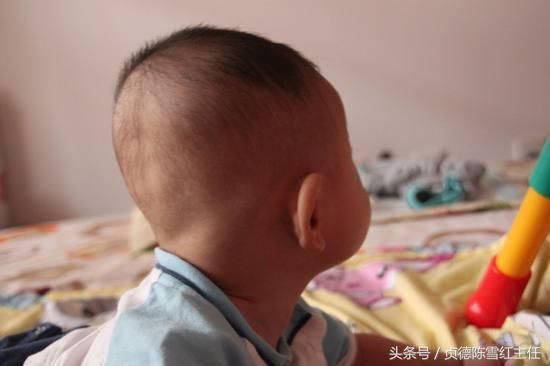 你家宝宝怎么是扁头?矫正宝宝头扁的几个小技