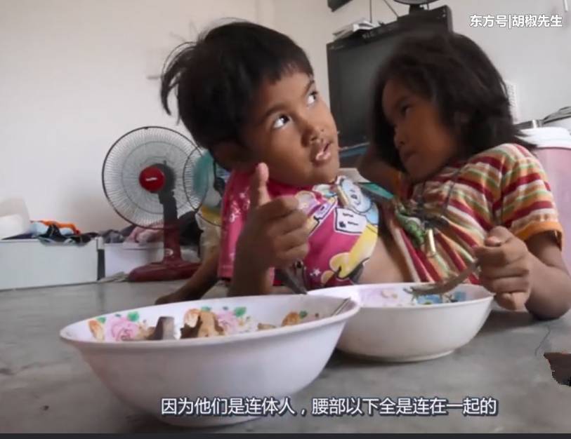 所以他们的父母很想去医院为他们做分离手术,但是手术费用非常昂贵。他们的家境又不是很好的。为了给两个孩子凑集手术费,父母只能省吃俭用,等攒够了钱就给他们做手术。但是但凡动手术,无论手术大小都是要存在风险的。像人体分离这种大的手术肯定风险非常大,所以说,这对龙凤胎还面临一个巨大的手术风险。生活本来已经充满坎坷,可是命运偏偏还要给他们的生命加上一把枷锁。