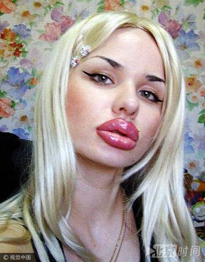 2011年，俄罗斯少女Kristina Rei对于硅胶植入嘴唇手术陷入痴迷状态。曾经是少年的时候，她就觉得自己的的薄嘴唇没有吸引力。就在她到了可以进行硅胶植入手术的年龄，她迅速的将自己的嘴唇变厚。她希望自己能够变成世界上最厚的嘴唇。