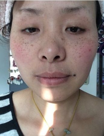 当牙膏拌上它,每天坚持擦一擦,斑点纷纷往下掉