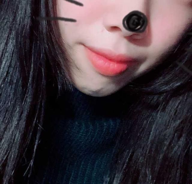 牙套小萌新的整牙日记:龅牙,短下巴,拔四颗牙