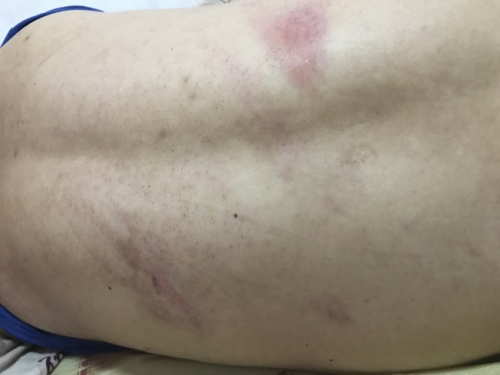 纽约警察执法进错门 华人男子家中睡觉突遭暴打