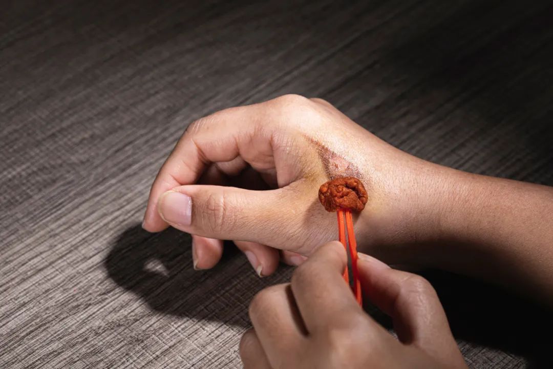 真相| 身上有伤口,吃酱油会变黑吗?答案是.