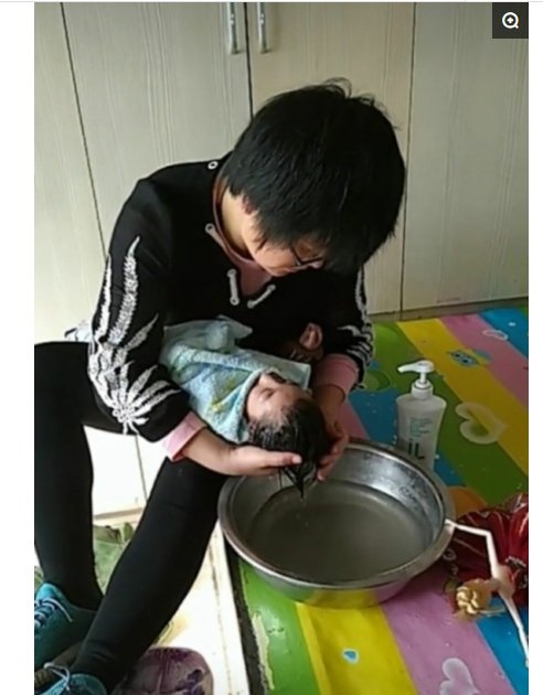 16岁女孩像1岁小孩,身高64厘米体重10斤,网友