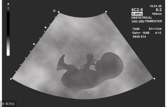 B超数据、孕囊大小、孕囊形状都在告诉你是男