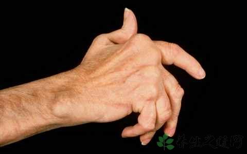 女生风湿热会引起小便多么