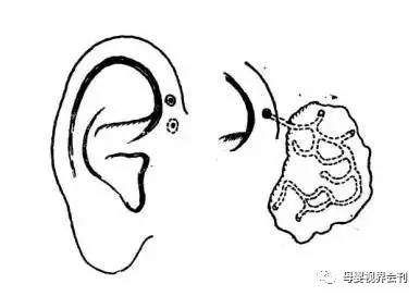 你家宝宝耳朵上有这种小孔吗?如果有,就要小心