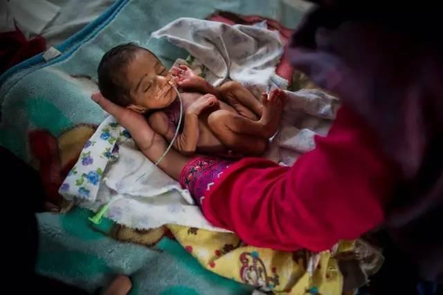 经常一个孕妇还没有生完，就有下一个孕妇要生。就像一个流水线，不断地有婴儿被生产出来。 在孕产妇死亡率极高的当地，她所在的三个月里，没有一例孕产妇死亡。