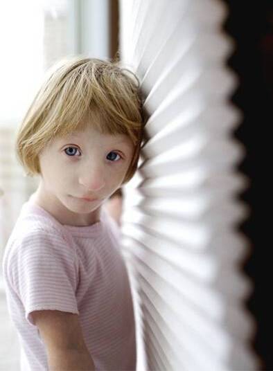 全世界最小的女孩 能活着就是一个奇迹