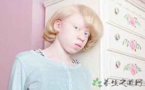 白化病的早期症状有哪些