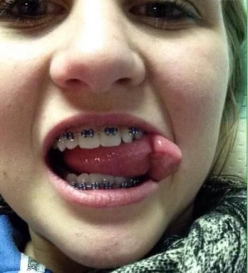 美女,你这一口钢牙,着实可怕