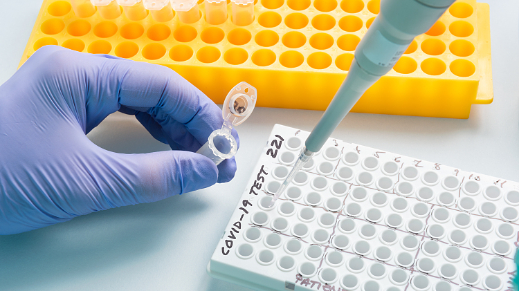 云南昨日新增1例本土确诊,在瑞丽全员核酸检测中发现 云南昨日新增1例本土确诊,在瑞丽全员核酸检测中发现
