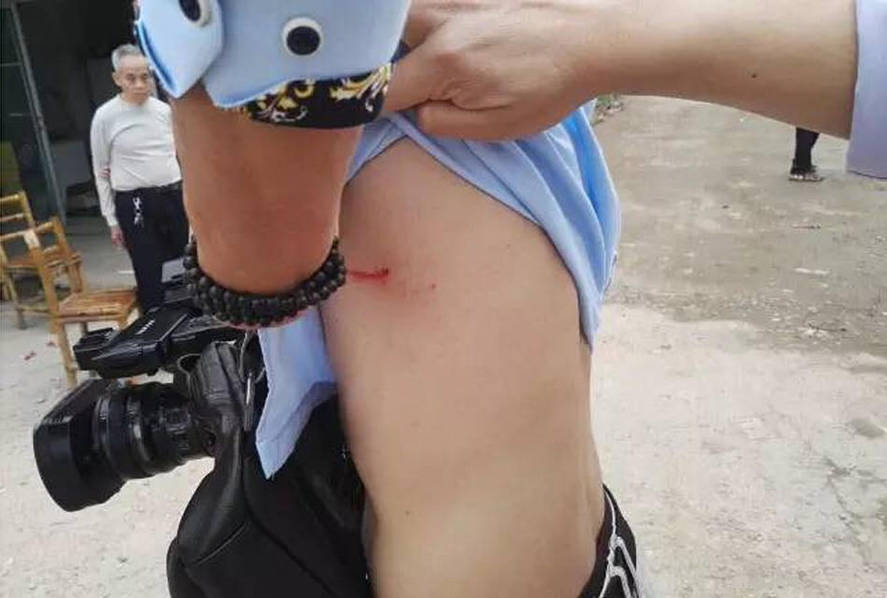记者采访被打摄像机被抢 打人者:叫你们台长来拿 记者采访被打摄像机被抢 打人者:叫你们台长来拿