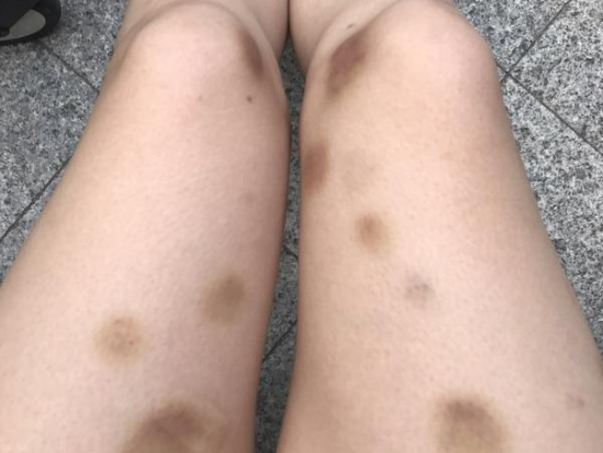 女子装探头拍下被家暴过程 前夫:她自愿的