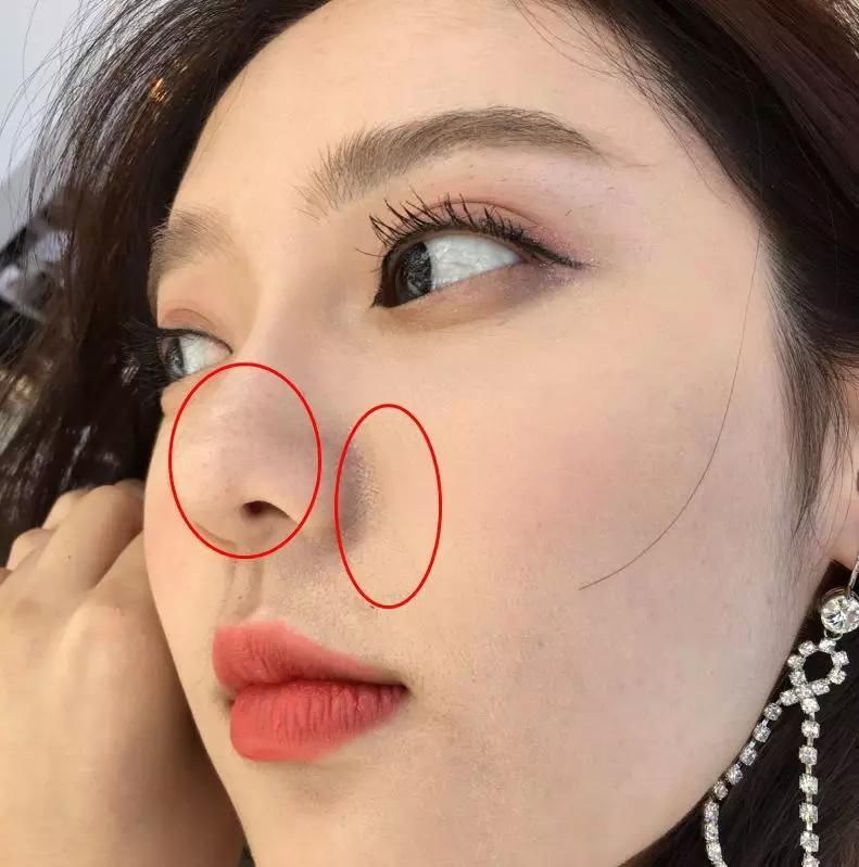 蔡徐坤、Angelababy都根治不掉的黑头,微商神