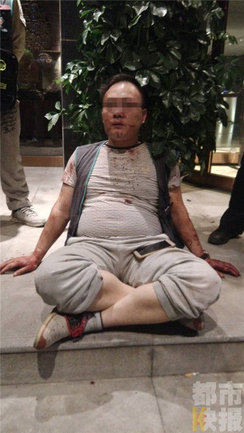 西安代驾司机浑身是血 称被一休闲会馆保安殴打