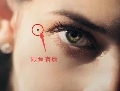 痣長在哪裏特別要注意 有這些痣的人 男富女貴 事業有成 雪花新闻 痣長在哪裏特別要注意 有這些痣的人 男富女貴 事業有成 雪花新闻