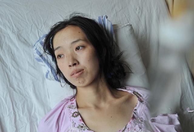 38岁美女教师患大肠癌丧命,只要上厕所有这种