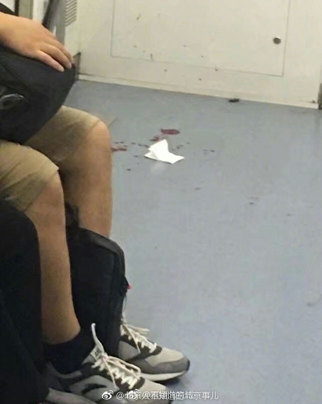 血迹斑斑。