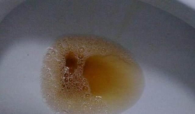 男人这6种行为最伤肾,特别是最后一种你可能天