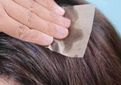 出油脱发,头皮发痒,十之八九元凶是头螨,2方法