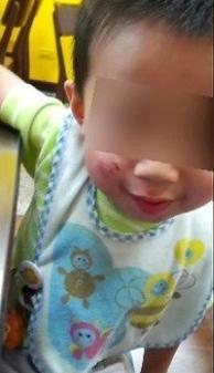 2岁女童误触油门 机车冲进早餐店撞飞4人 2岁女童误触油门 机车冲进早餐店撞飞4人