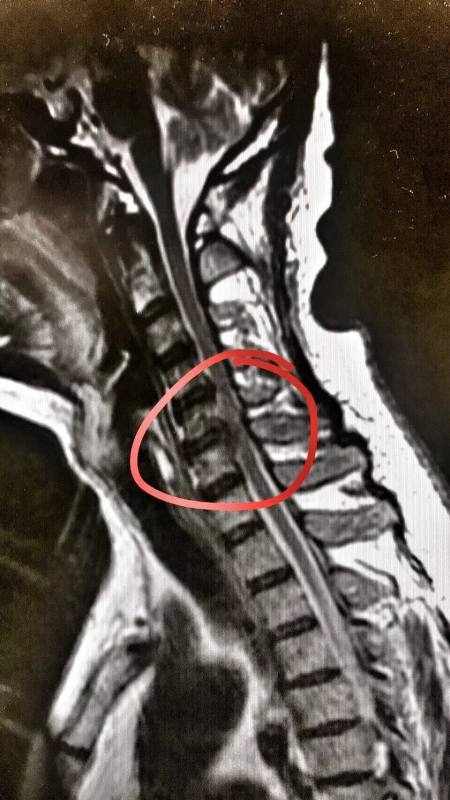 薛蛮子《告 低头 同胞书》