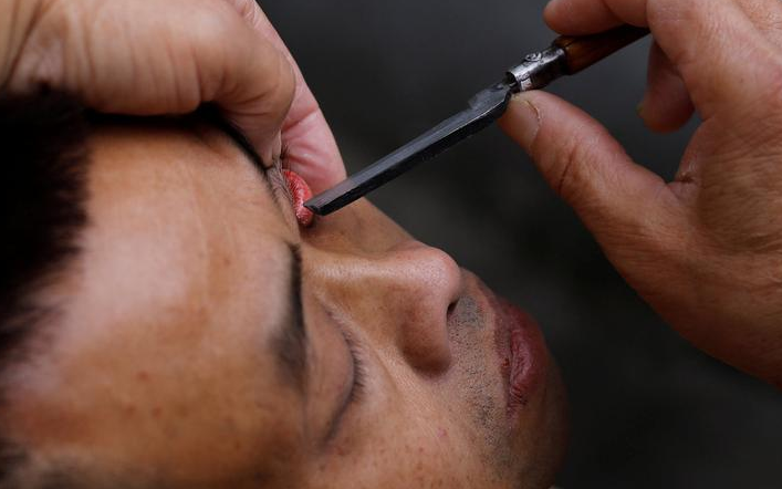 2017年11月18日，四川成都，62岁的街头理发师熊高武为顾客展示刀锋洗眼。熊高武自17岁起就在街头理发。人称“熊三师”的他有三个独门绝技：刀锋洗眼、跳三刀、舒筋。其中最令人称绝的就是刀锋洗眼也就是用锋利的刀片“扫”眼皮，据说只要体验过一次，就不会忘记。