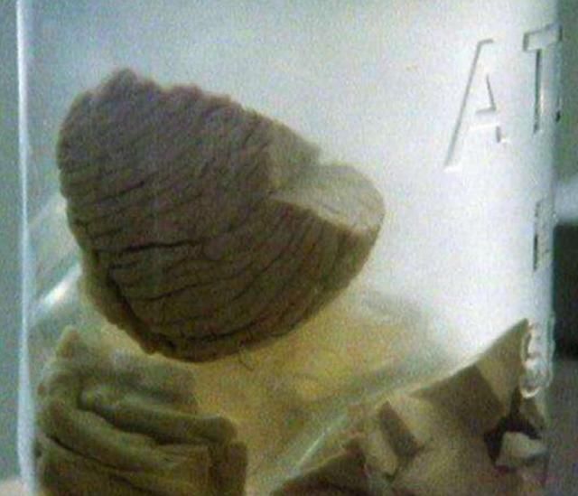 把爱因斯坦的大脑被切成240片,结果什么都没研