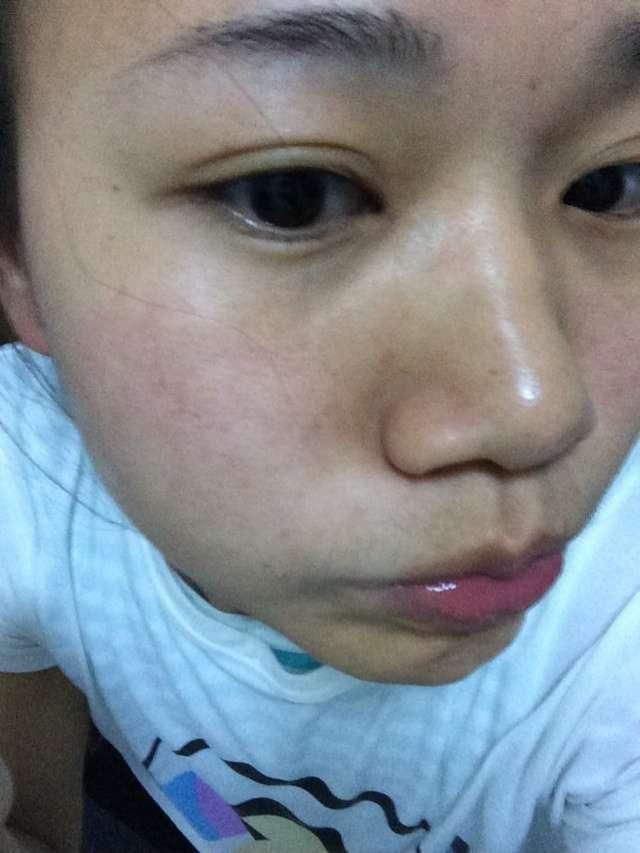 长了斑点怎么办?药店一常见药膏,7天美白祛斑