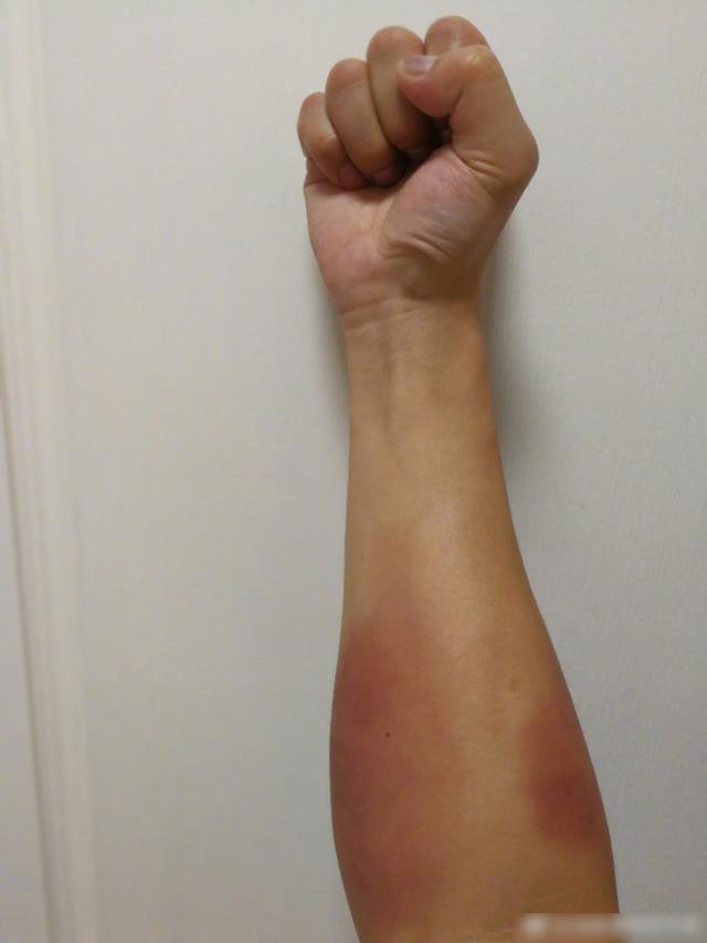 邹市明训练回家手臂红肿 暖心胖轩又是亲又是冰敷