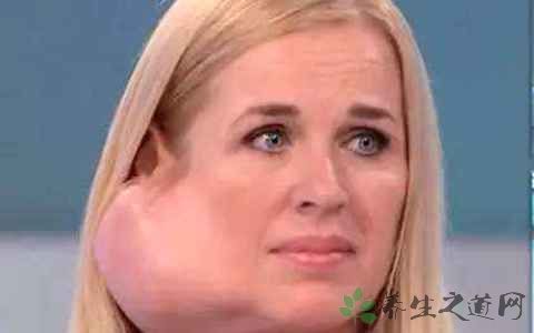 腮腺肿瘤有哪些临床表现