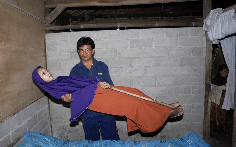 35岁印尼女子身体像根木头,已经10年没有弯过腰,没有坐下过