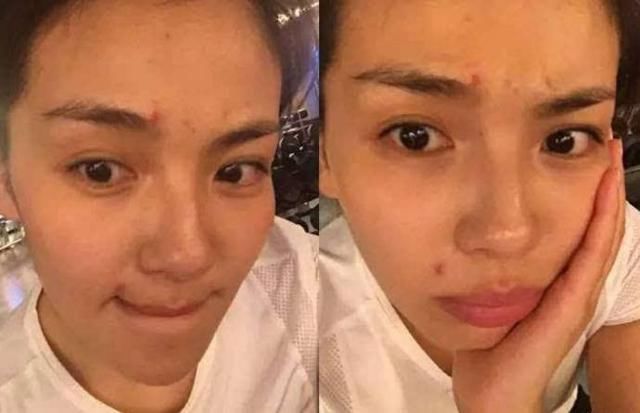 明星爆痘烂脸合集!迪丽热巴皮肤差?王俊凯,张