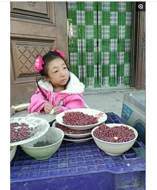 16岁女孩像1岁小孩,身高64厘米体重10斤,网友