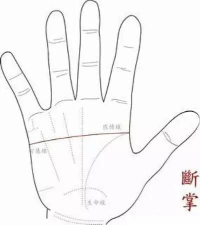 断掌到底意味着什么 断掌到底意味着什么